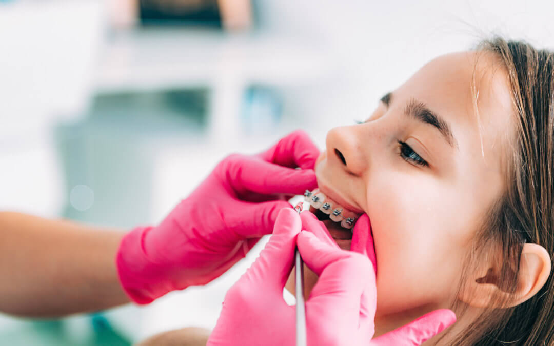 Your Child’s First Visit to a Pediatric Dentist Near Me Suwanee
